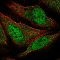 GEMIN8 Antibody, Novus Biologicals 0.1mL; Unlabeled:Antibodies, Polyclonal